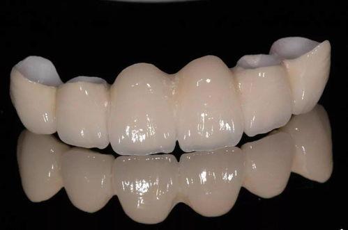 国产全瓷牙效果图大全视频,高清图集与视频展示